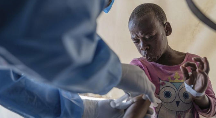 Accélération de la vaccination contre le mpox : une approche coordonnée pour renforcer les systèmes de santé en Afrique